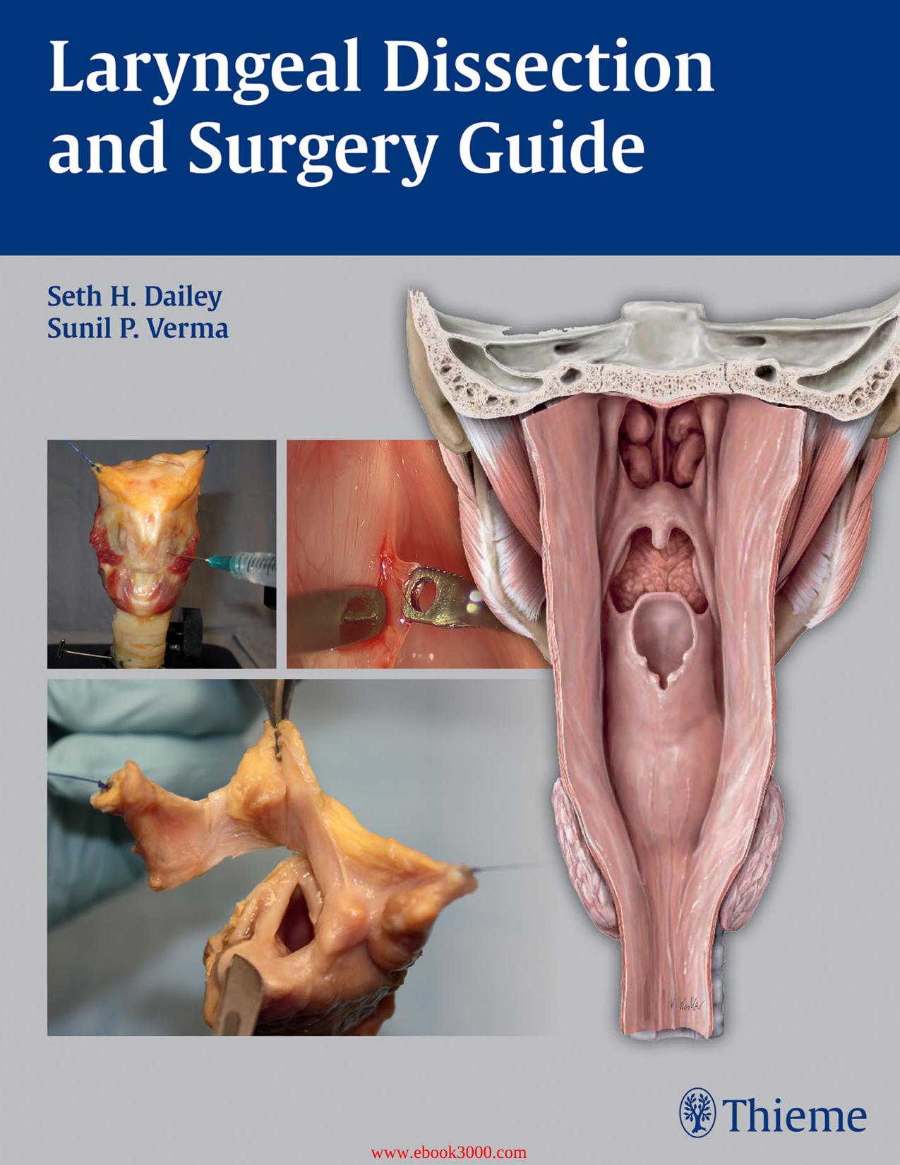 Laryngeal Dissection and Surgery Guide by Unknow