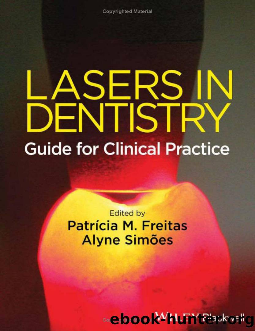 Lasers in Dentistry by Guide for Clinical Practice