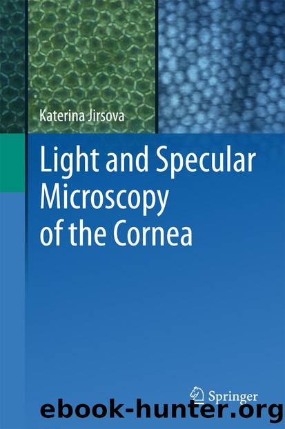 Light and Specular Microscopy of the Cornea by Katerina Jirsova