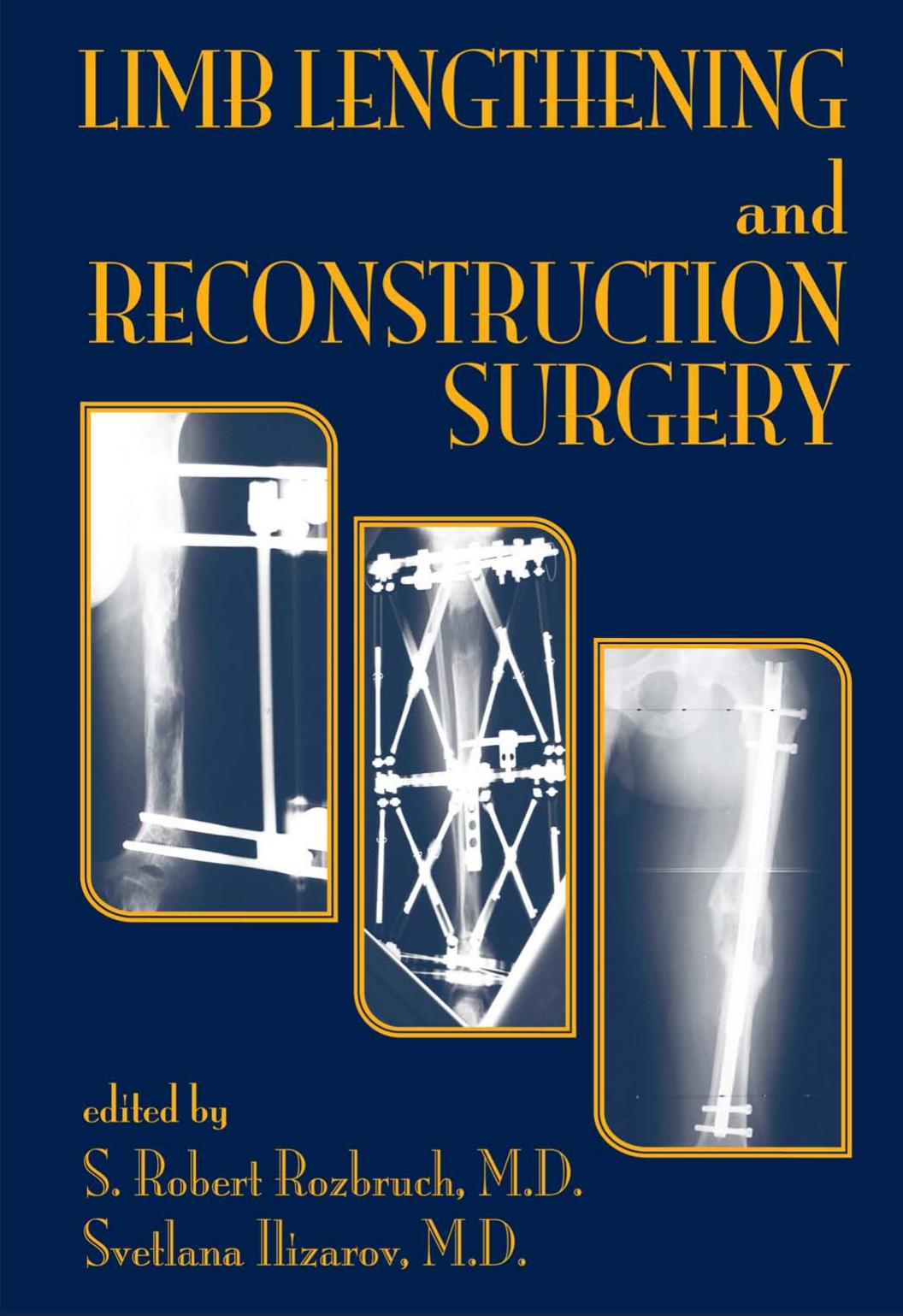Limb Lengthening and Reconstruction Surgery by Rozbruch S. Robert