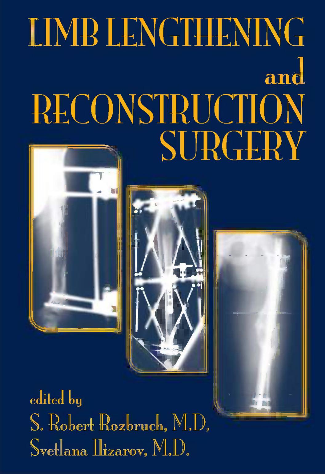 Limb lengthening and reconstructive surgery by S Robert Rozbruch; Svetlana Ilizarov