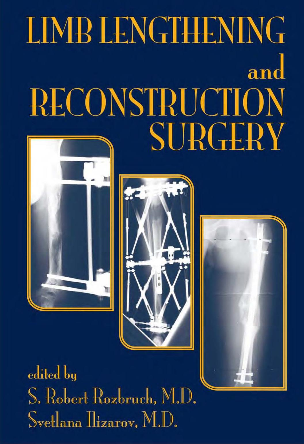 Limb lenthening and reconstructive surgery by Robert Rozbruch S. Svetlana Ilizarov