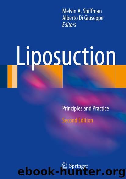 Liposuction by Melvin A. Shiffman & Alberto Di Giuseppe