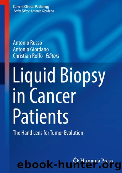 Liquid Biopsy in Cancer Patients by Antonio Russo Antonio Giordano & Christian Rolfo