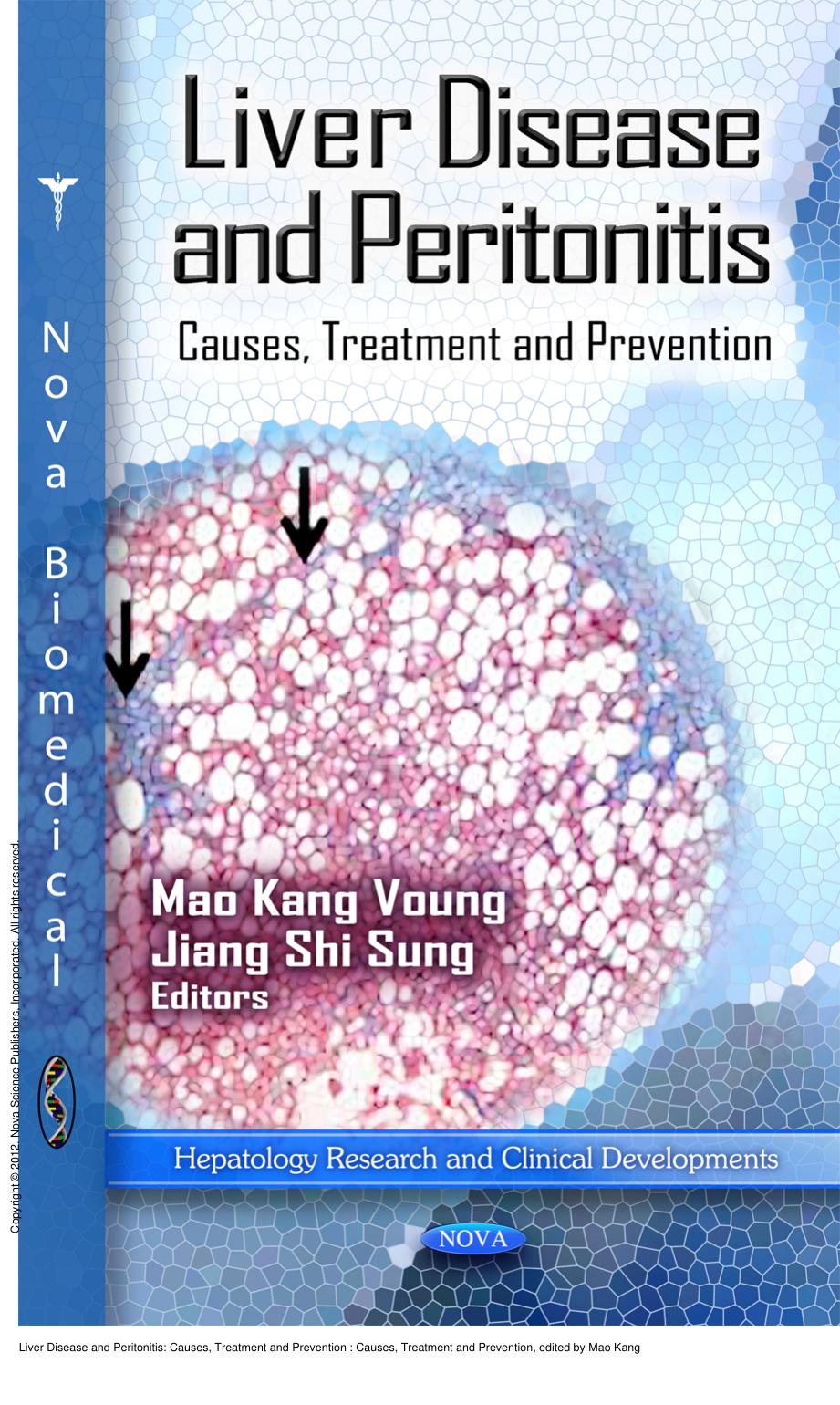Liver Disease and Peritonitis: Causes, Treatment and Prevention : Causes, Treatment and Prevention by Mao Kang Voung; Jiang Shi Sung