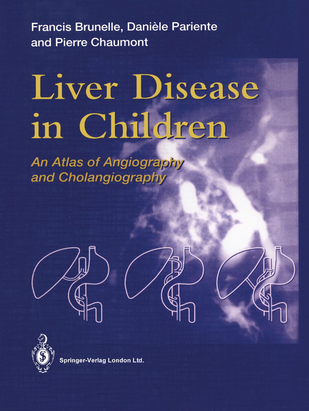 Liver Disease in Children: An Atlas of Angiography and Cholangiography by Francis Brunelle Danièle Pariente MD Pierre Chaumont MD (auth.)