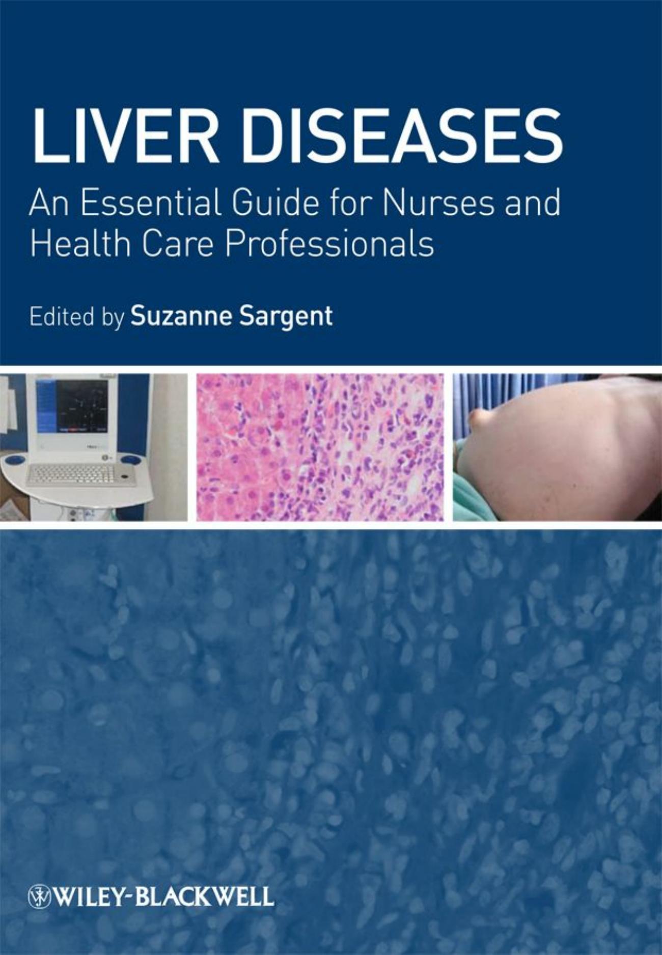 Liver Diseases: An Essential Guide for Nurses and Health Care Professionals by Suzanne Sargent