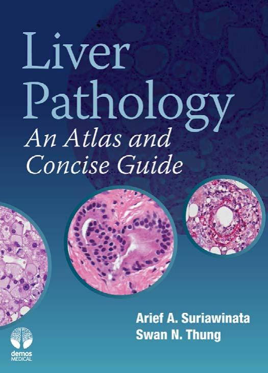 Liver Pathology: An Atlas and Concise Guide by Suriawinata Arief A. Thung Swan N