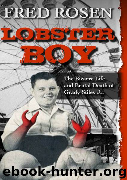 Lobster Boy by Fred Rosen