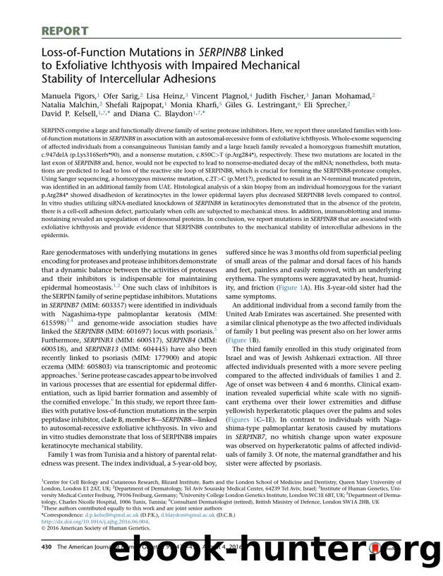 Loss-of-Function Mutations in SERPINB8 Linked to Exfoliative Ichthyosis with Impaired Mechanical Stability of Intercellular Adhesions by unknow