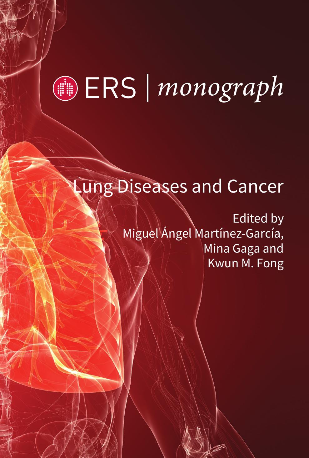 Lung Diseases and Cancer by Miguel Angel Martinez Garcia Mina Gaga and Kwun M. Fong