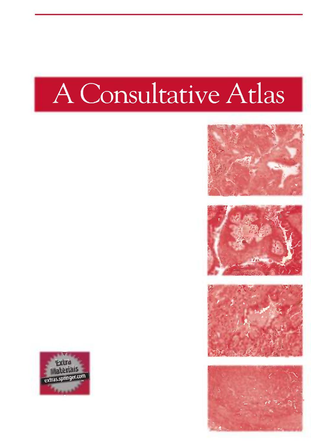 Lung Pathology: A Consultative Atlas by Stuart Houser MD Ulysses J. Balis MD Eugene J. Mark MD (auth.)