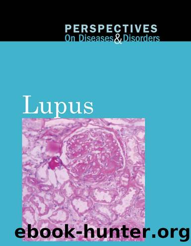 Lupus by Hayley Mitchell Haugen