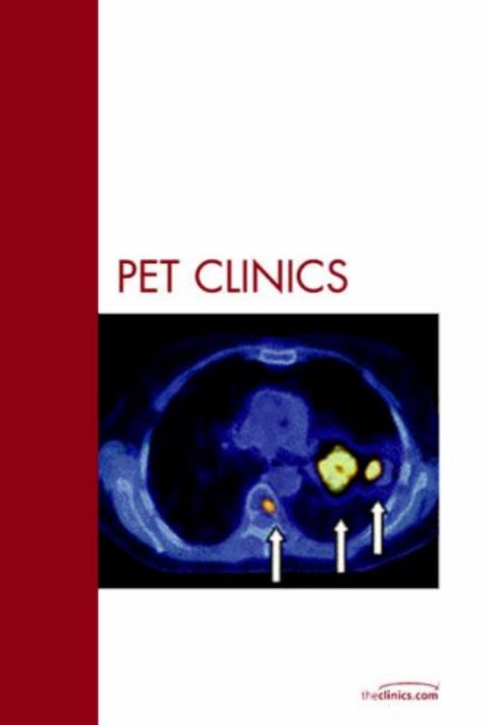 Lymphoma, An Issue of PET Clinics by Ora Israel