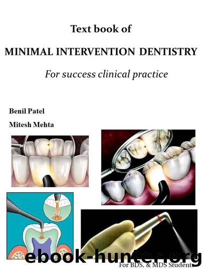 MINIMAL INTERVENTION DENTISTRY by Mehta Mitesh & Patel Benil
