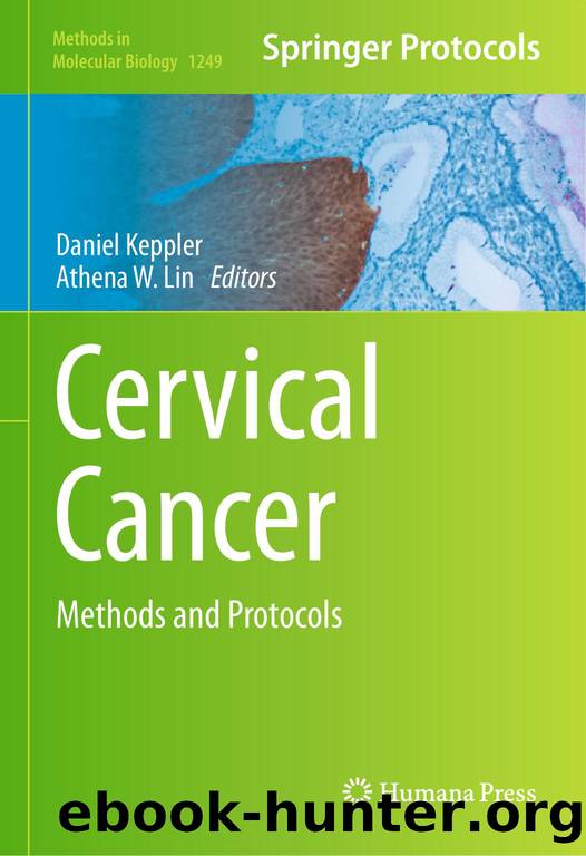 MMB vol.1249 Keppler D., Lin A.W. (eds.) Cervical Cancer.. Methods and Protocols (Humana Press, 2015)(ISBN 9781493920129)(429s) by Unknown