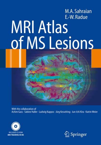 MRI Atlas of MS Lesions by Unknown