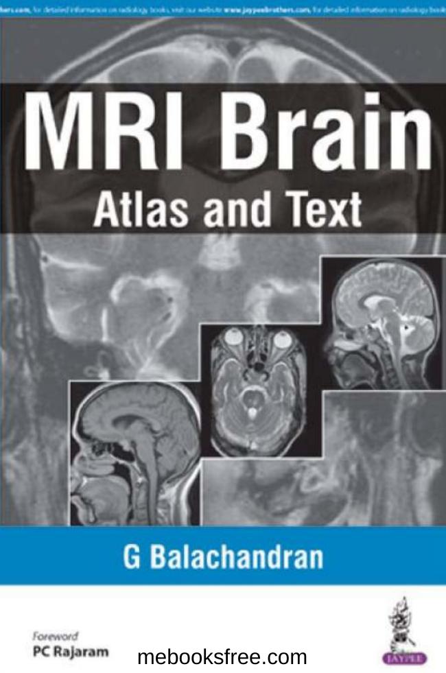 MRI Brain: Atlas and Text by M.D. Balachandran G