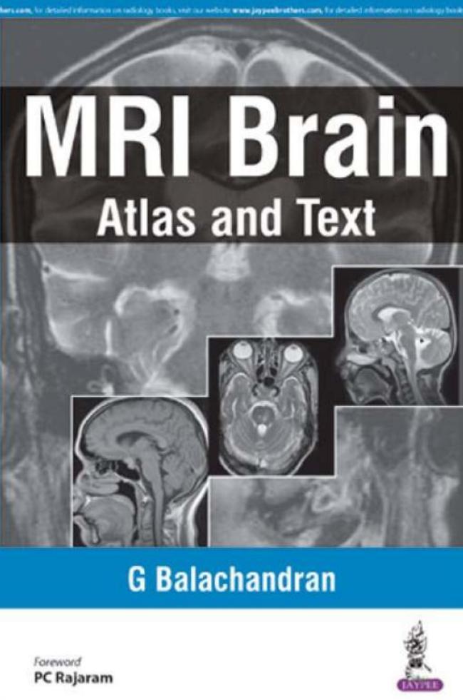 MRI Brain: Atlas and Text by Unknow