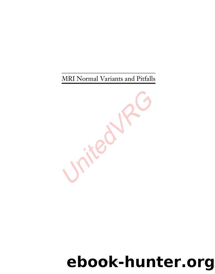 MRI Normal Variants and Pitfalls by Bancroft Laura W.(Author)