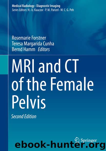 MRI and CT of the Female Pelvis by Rosemarie Forstner Teresa Margarida Cunha & Bernd Hamm