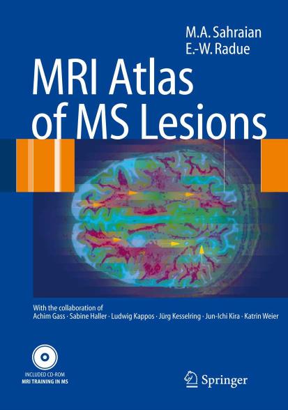 MRI atlas of MS Lesions by unknow