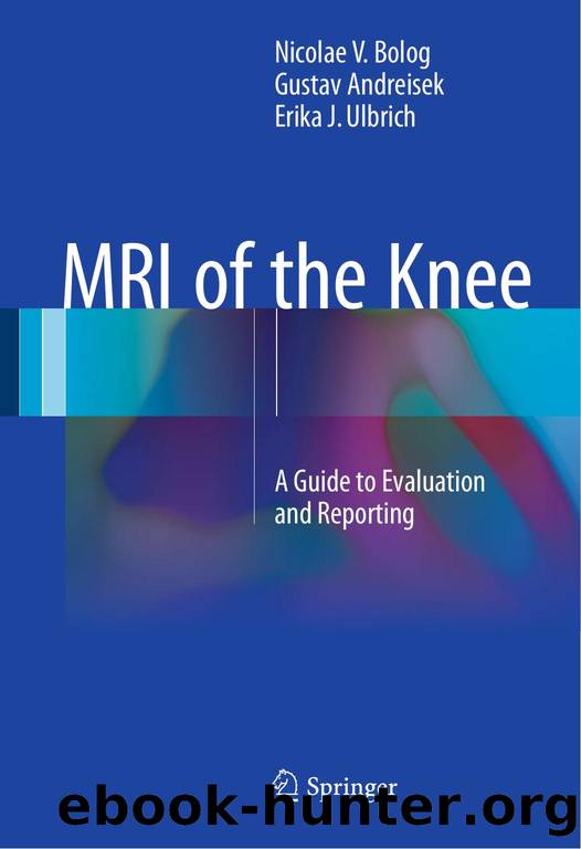 MRI of the Knee  A Guide to Evaluation and Reporting by Nicolae V. Bolog by Unknown