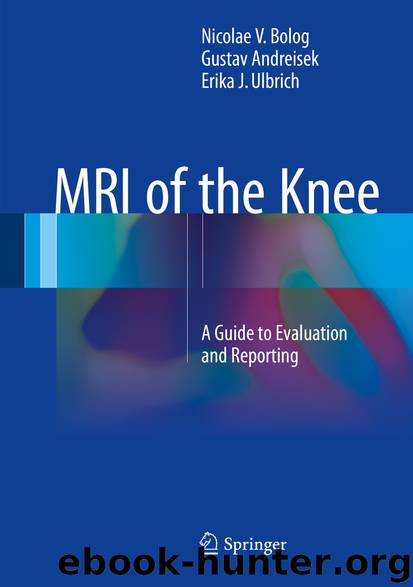 MRI of the Knee by Nicolae V. Bolog Gustav Andreisek & Erika J. Ulbrich