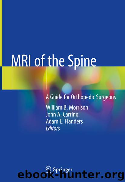MRI of the Spine by Unknown