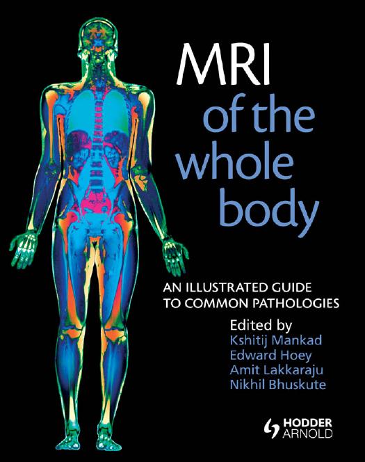 MRI of the Whole Body: An Illustrated Guide for Common Pathologies: An Illustrated Guide to Common Pathologies (repost) by Kshitij Mankad
