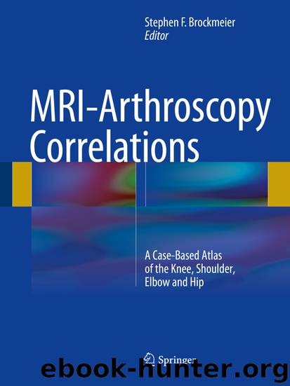 MRI-Arthroscopy Correlations by Stephen F. Brockmeier