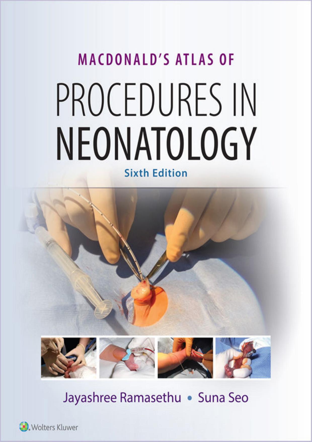 MacDonald's Atlas of Procedures in Neonatology by Unknow