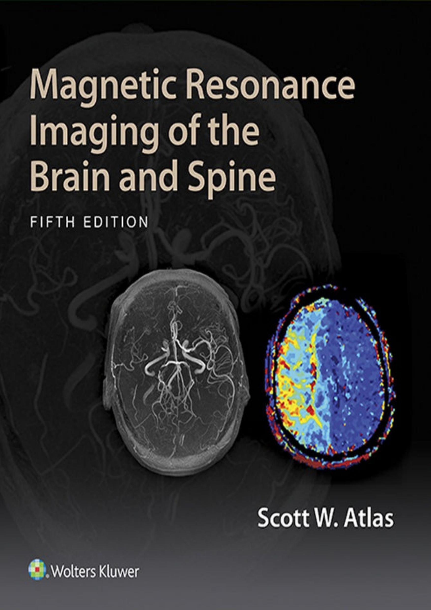 Magnetic Resonance Imaging of the Brain and Spine by Scott W. Atlas M.D