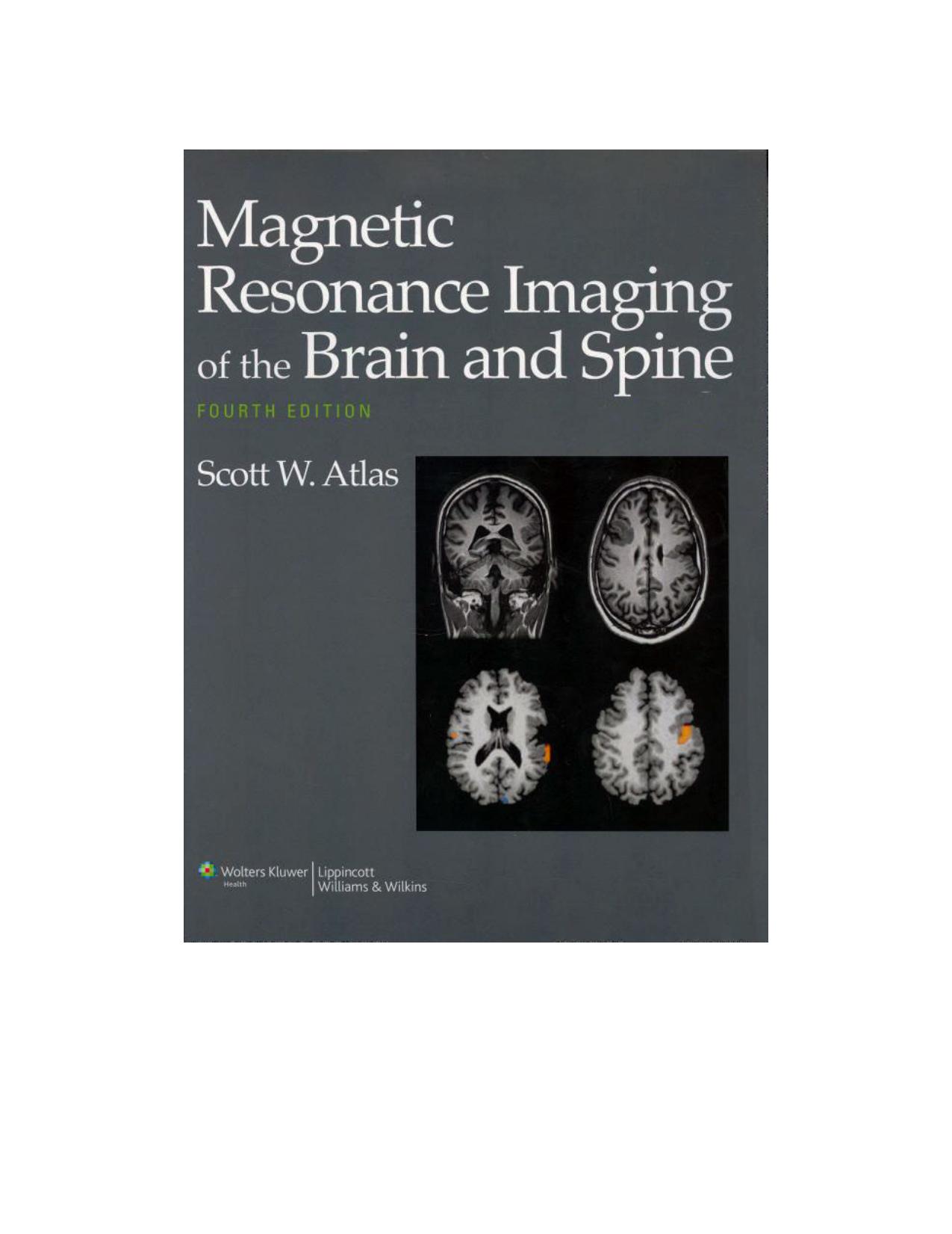 Magnetic resonance imaging of the brain and spine. 2 by Scott W Atlas