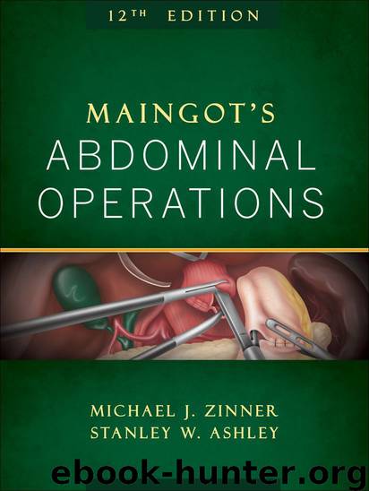 Maingot's Abdominal Operations, 12th Edition (Zinner, Maingot's Abdominal Operations) by Zinner Michael & Ashley Jr Stanley