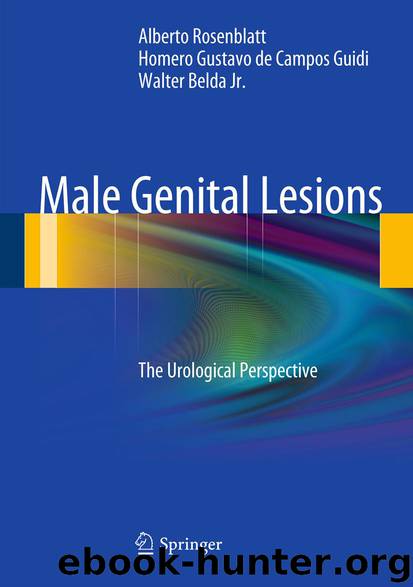 Male Genital Lesions by Alberto Rosenblatt Homero Gustavo Campos Guidi & Walter Belda Jr