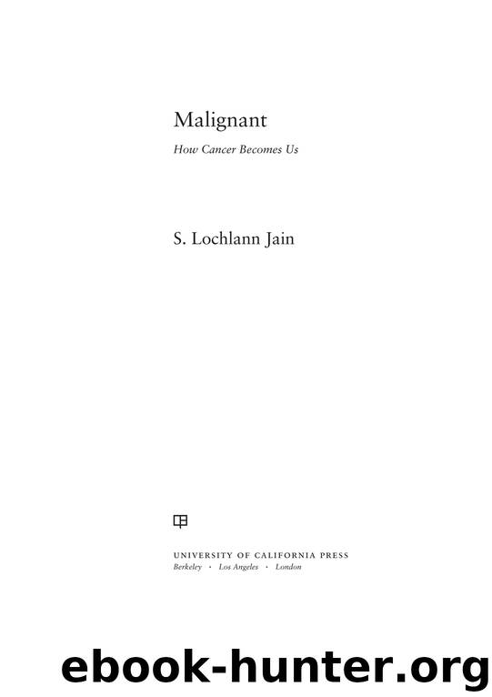 Malignant by S. Lochlann Jain