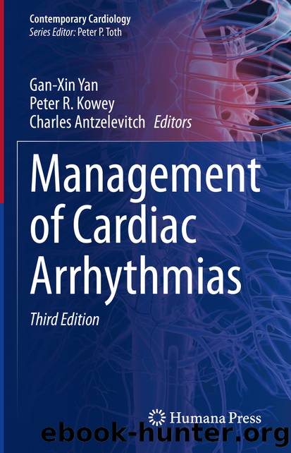 Management of Cardiac Arrhythmias by Unknown