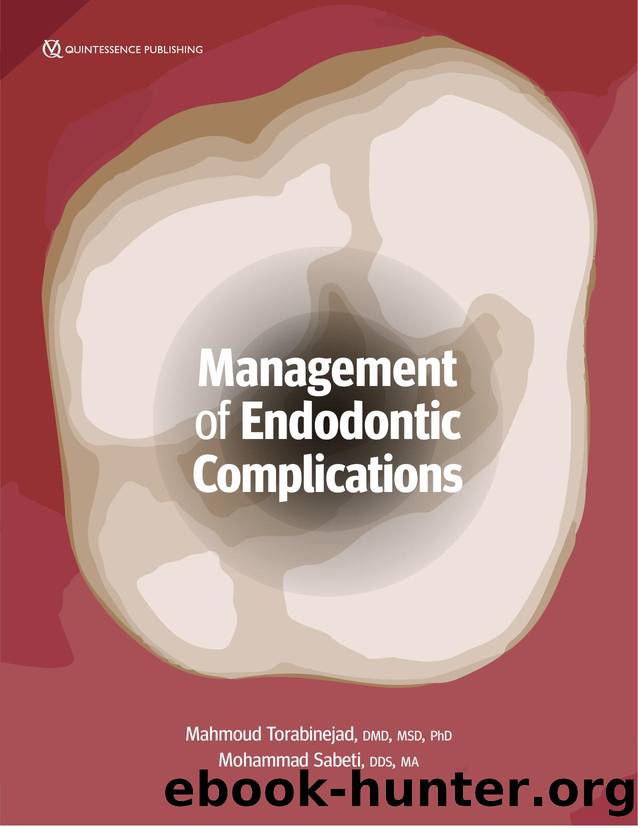 Management of Endodontic Complications by Unknown