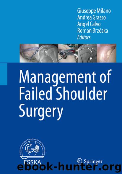 Management of Failed Shoulder Surgery by Giuseppe Milano Andrea Grasso Angel Calvo & Roman Brzóska