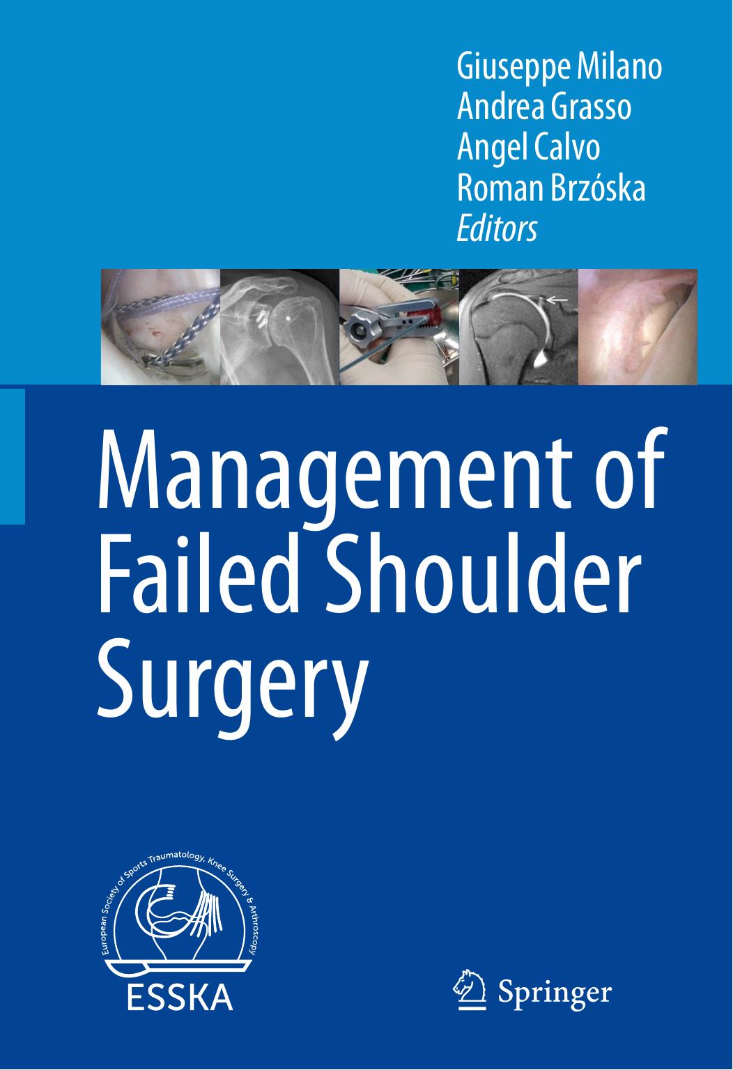 Management of Failed Shoulder Surgery by Giuseppe Milano Andrea Grasso Angel Calvo Roman Brzóska