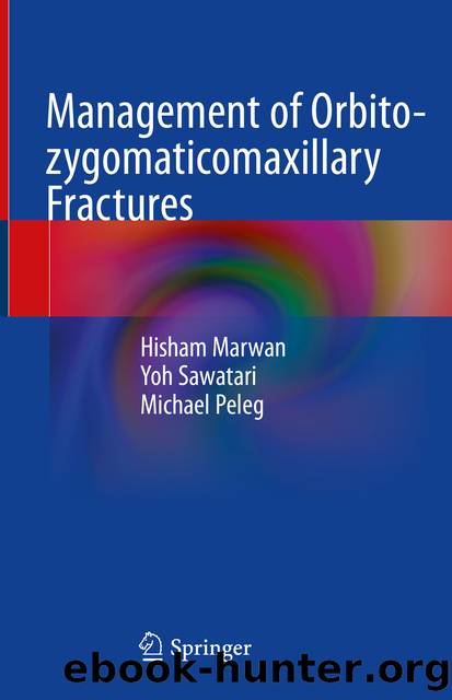Management of Orbito-zygomaticomaxillary Fractures by Hisham Marwan & Yoh Sawatari & Michael Peleg