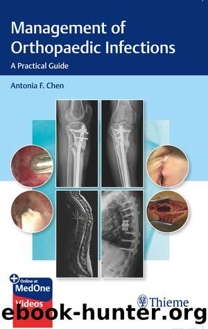 Management of Orthopaedic Infections by Antonia F. Chen;