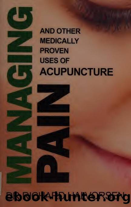 Managing pain : a user's guide to acupuncture by Halvorsen Richard