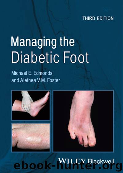 Managing the Diabetic Foot by Michael E. Edmonds & Alethea V.M. Foster