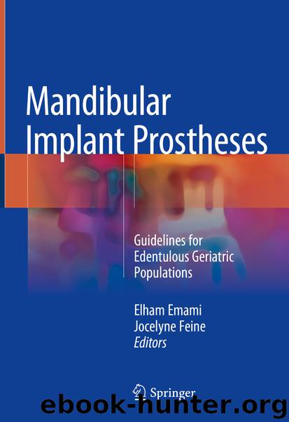 Mandibular Implant Prostheses by Elham Emami & Jocelyne Feine