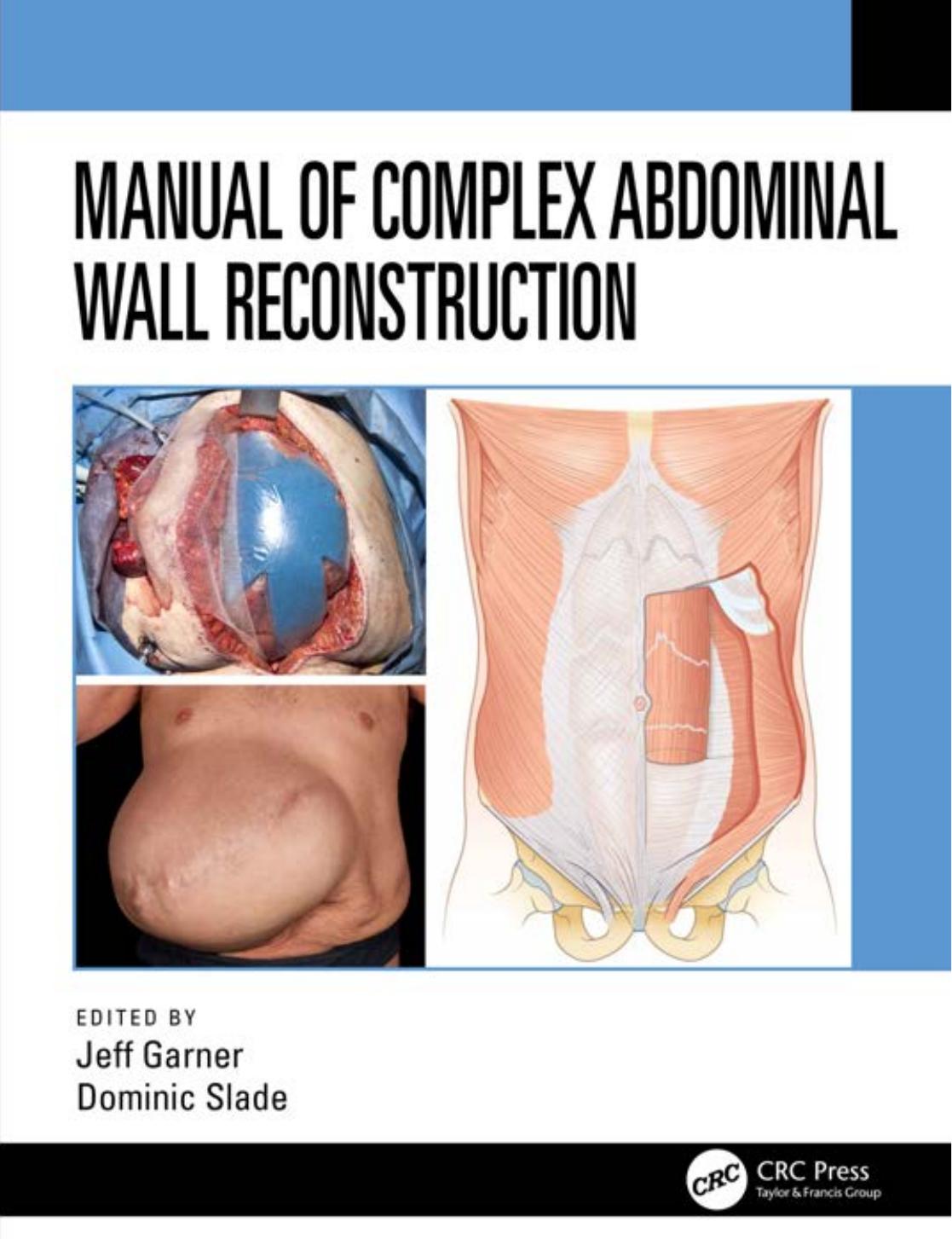 Manual of Complex Abdominal Wall Reconstruction by Jeff Garner; Dominic Slade