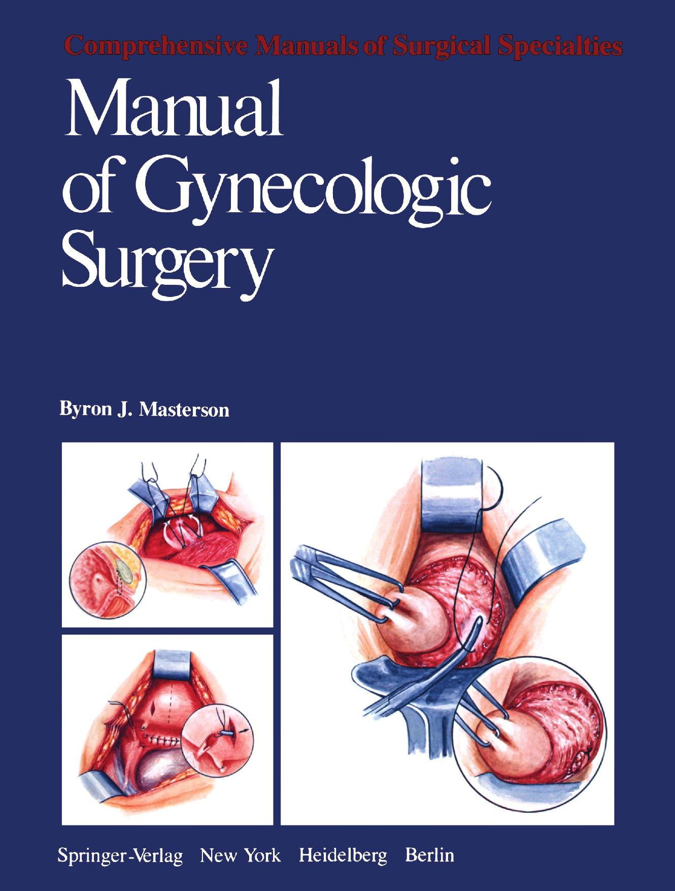 Manual of Gynecologic Surgery by Professor Byron J. Masterson M.D. (auth.)