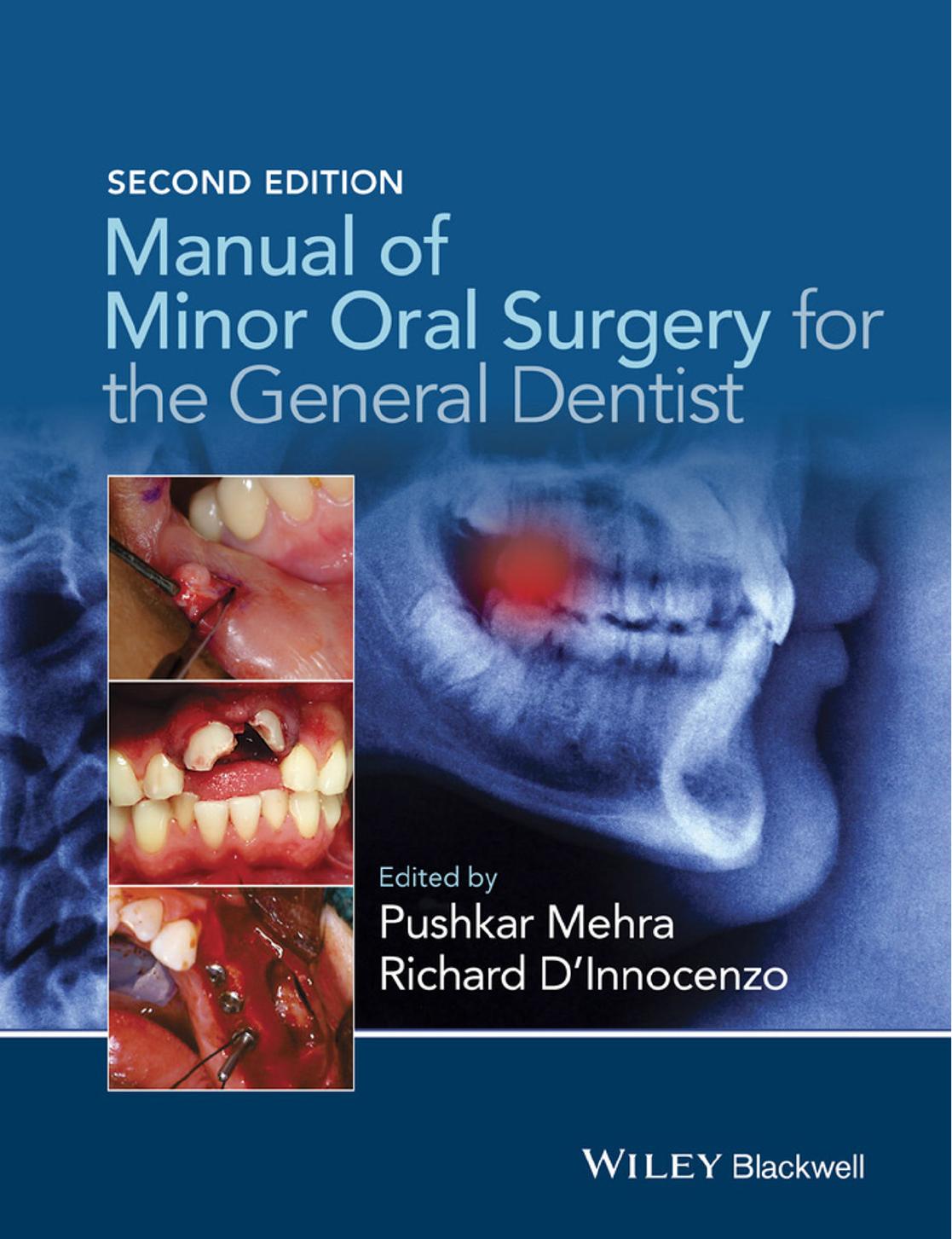 Manual of Minor Oral Surgery for the General Dentist, 2 edition (repost) by Pushkar Mehra and Richard DÂInnocenzo