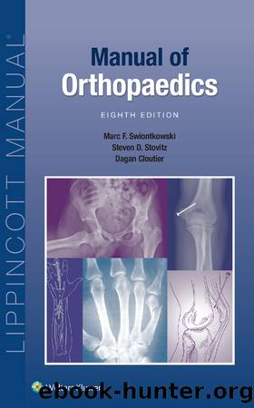 Manual of Orthopaedics by Marc F. Swiontkowski;